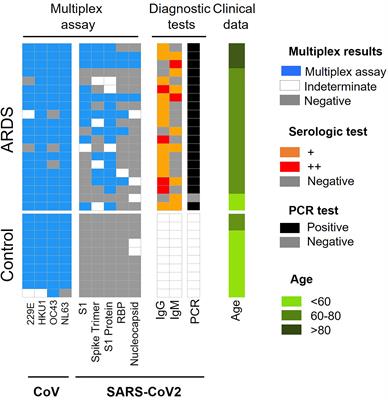 SARS-CoV-2 Infection Triggers Auto-Immune Response in ARDS